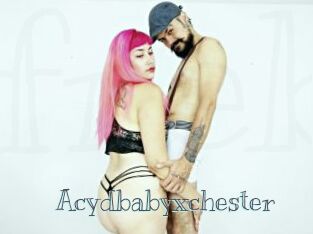 Acydbabyxchester